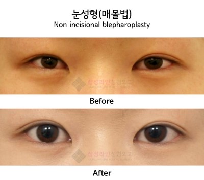 https://www.inlasik.co.kr/main/data/file/review/20110910140952720.JPG